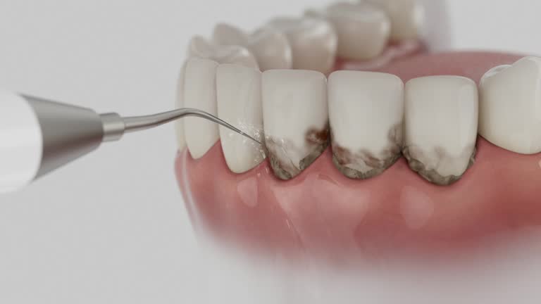 Reliable Wisdom Tooth Removal contractor in Humphreys County County, TN by Dentist Open Now